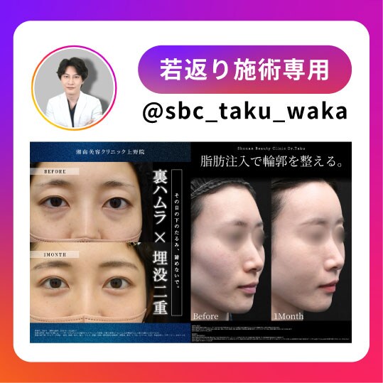 小顔instagram