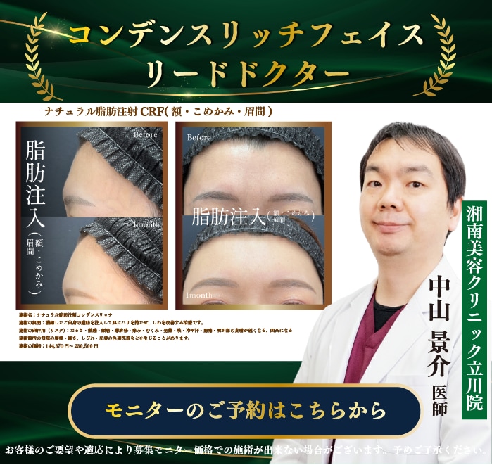 若返り