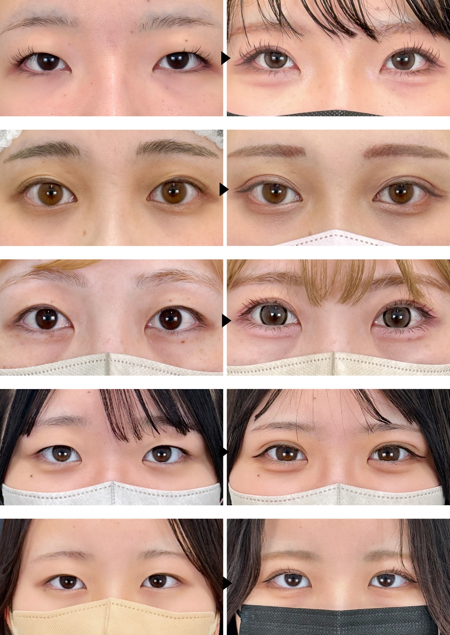 症例写真