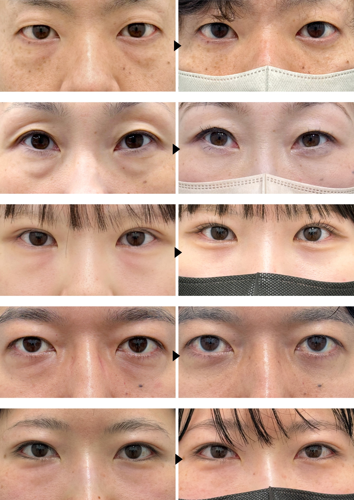 症例写真