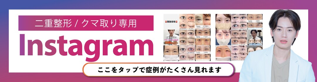 インスタ目元
