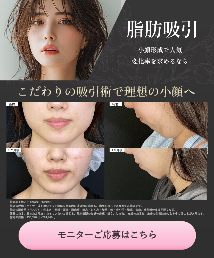 脂肪吸引