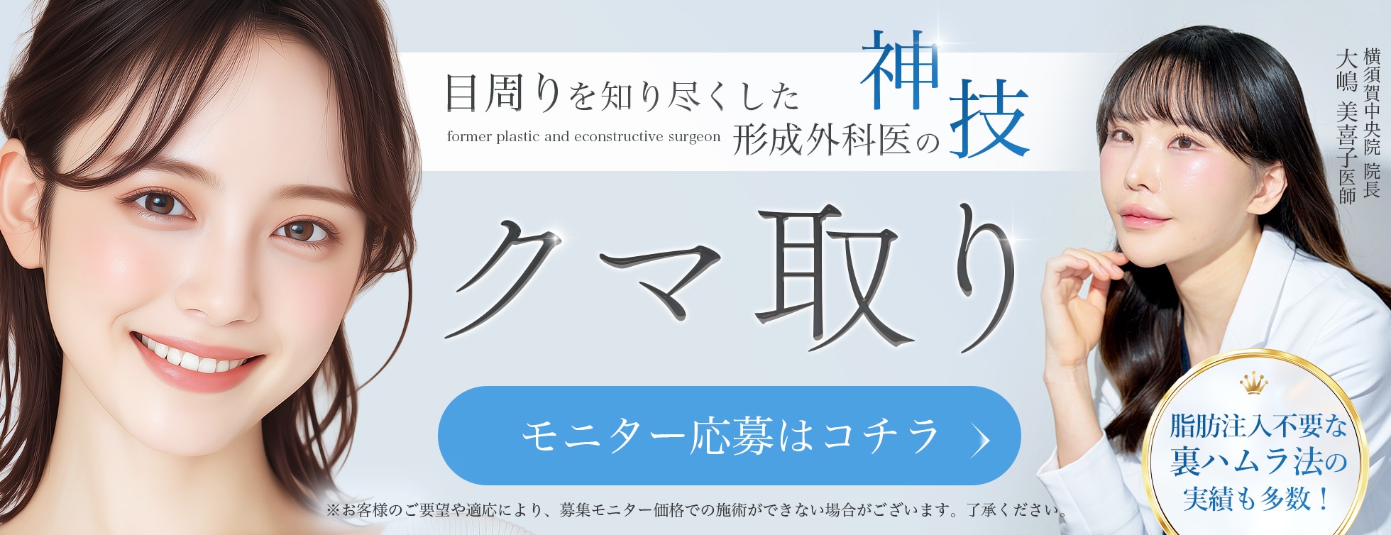 クマ取りモニター募集