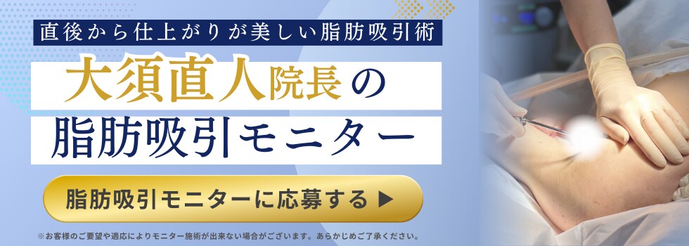 モニター募集