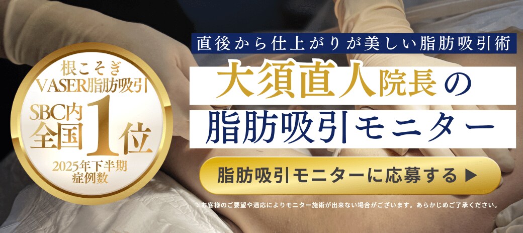 モニター募集