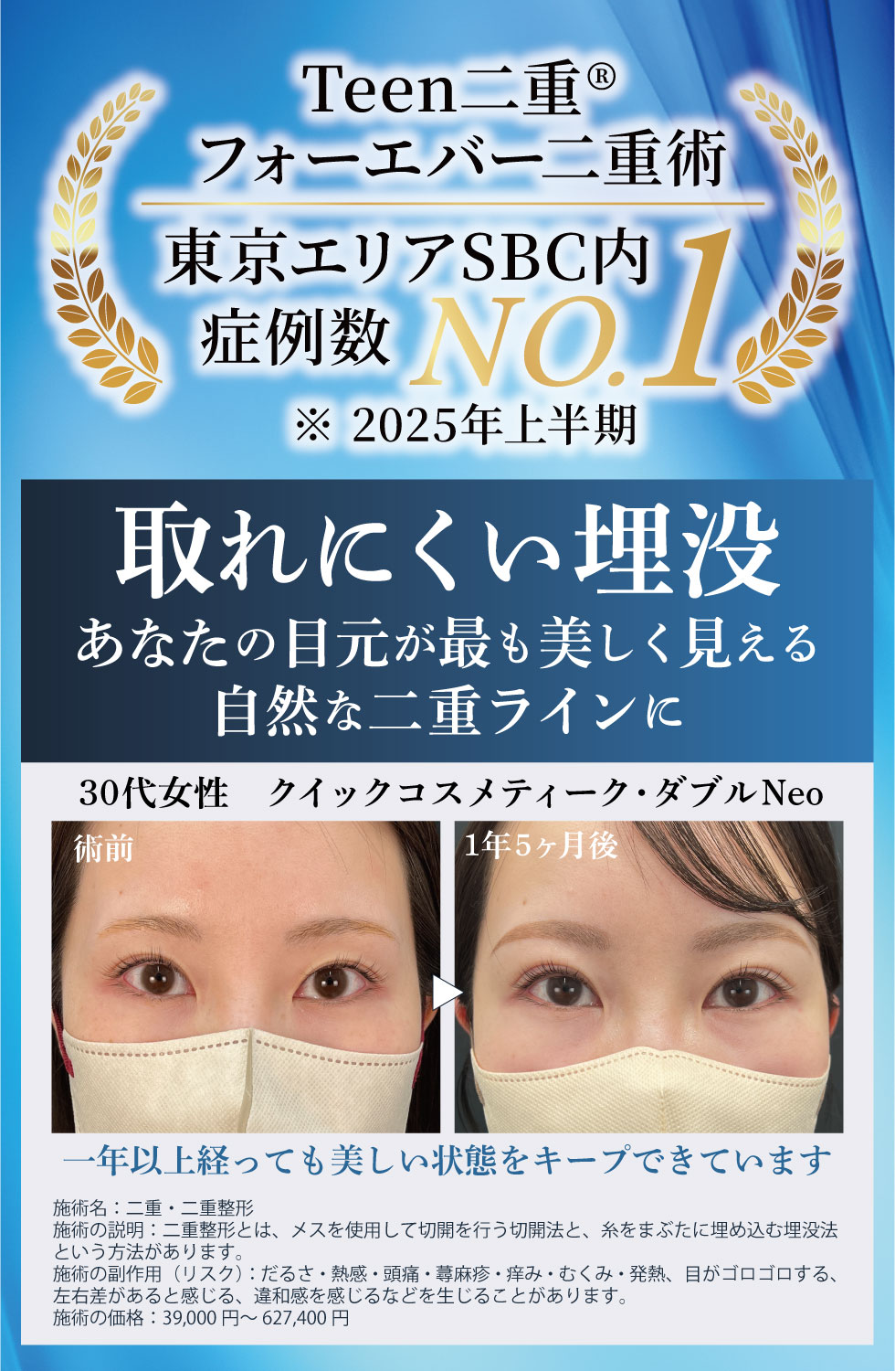 二重整形