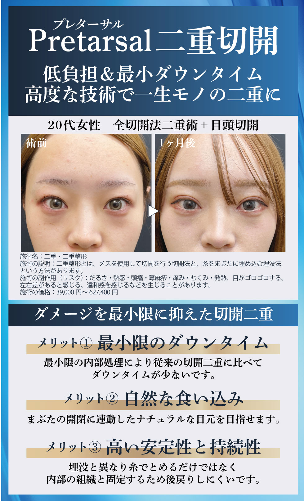 二重整形