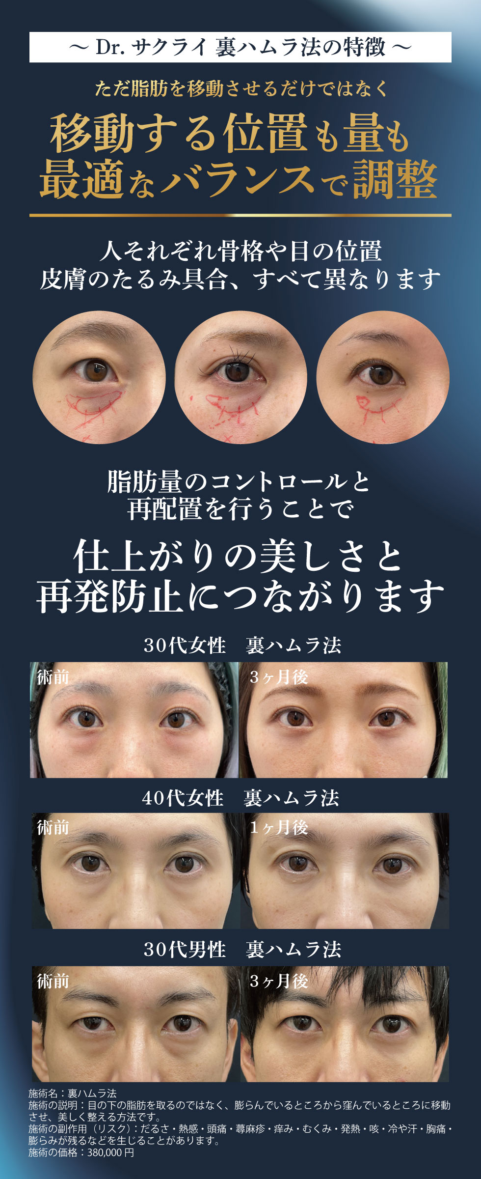 裏ハムラ