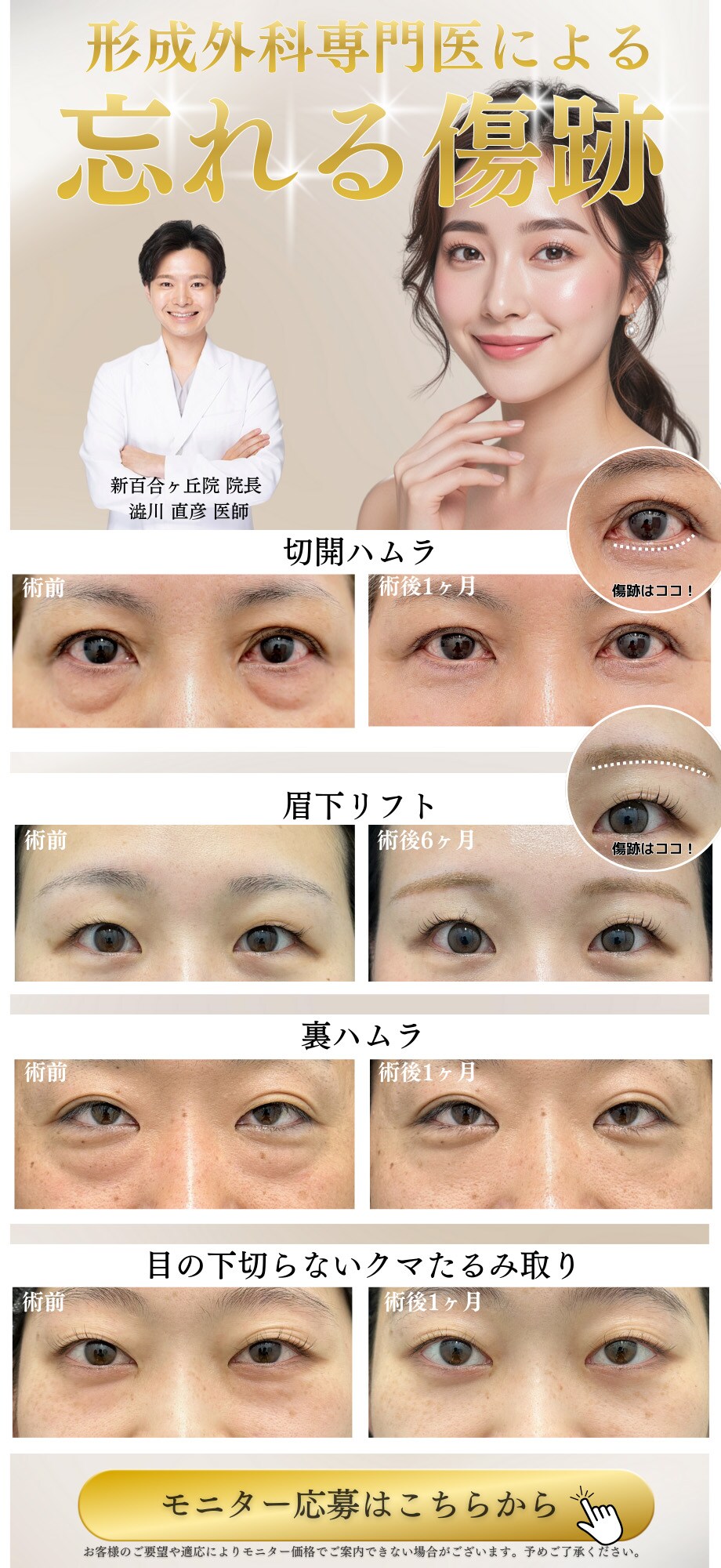 若返り術