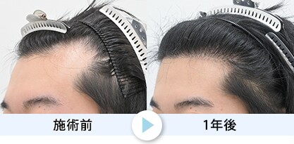 症例写真1