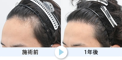 症例写真1