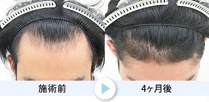 症例写真1
