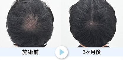 症例写真1