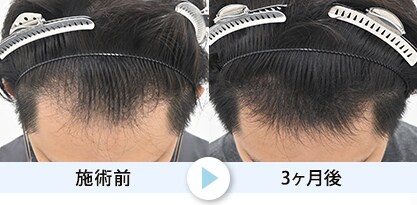 症例写真1