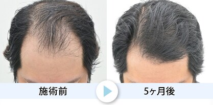 症例写真1
