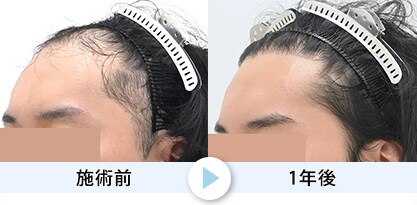 症例写真1