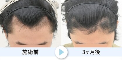 症例写真1