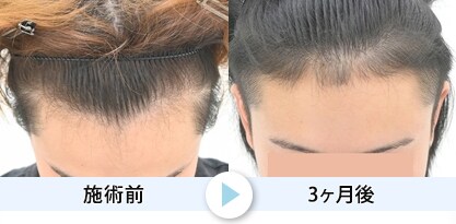 症例写真1