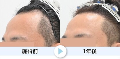 症例写真1