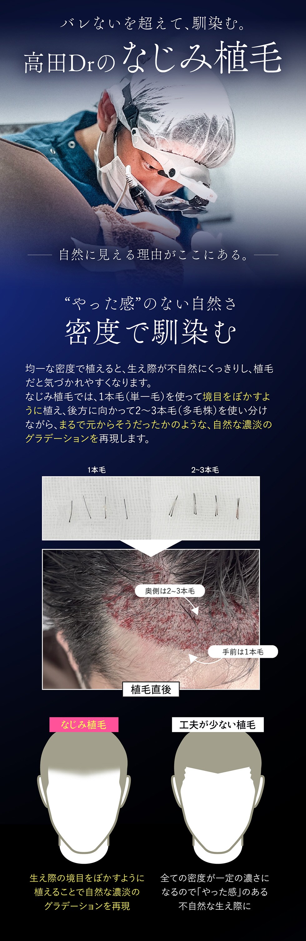 なじみ植毛