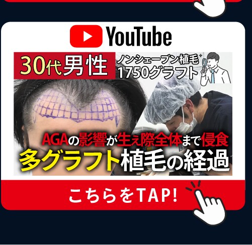 Instagram 豊胸