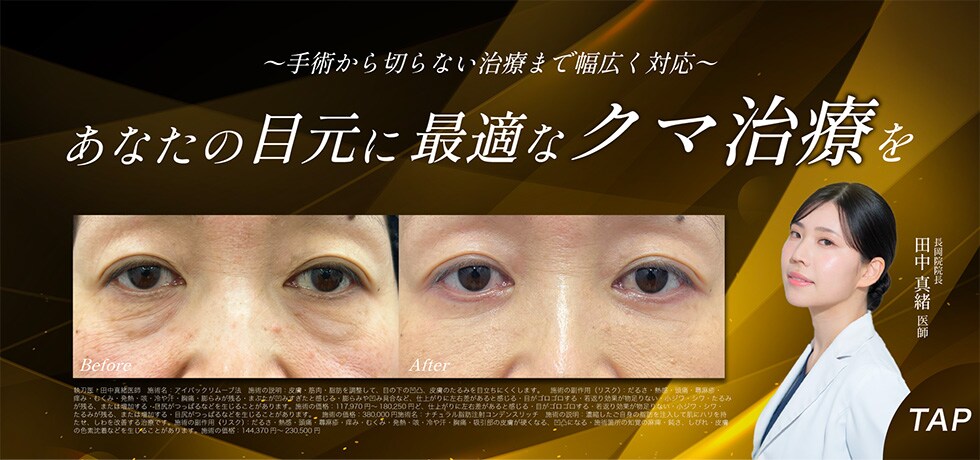 若返りの第一歩に。オーダーメイドのクマ治療