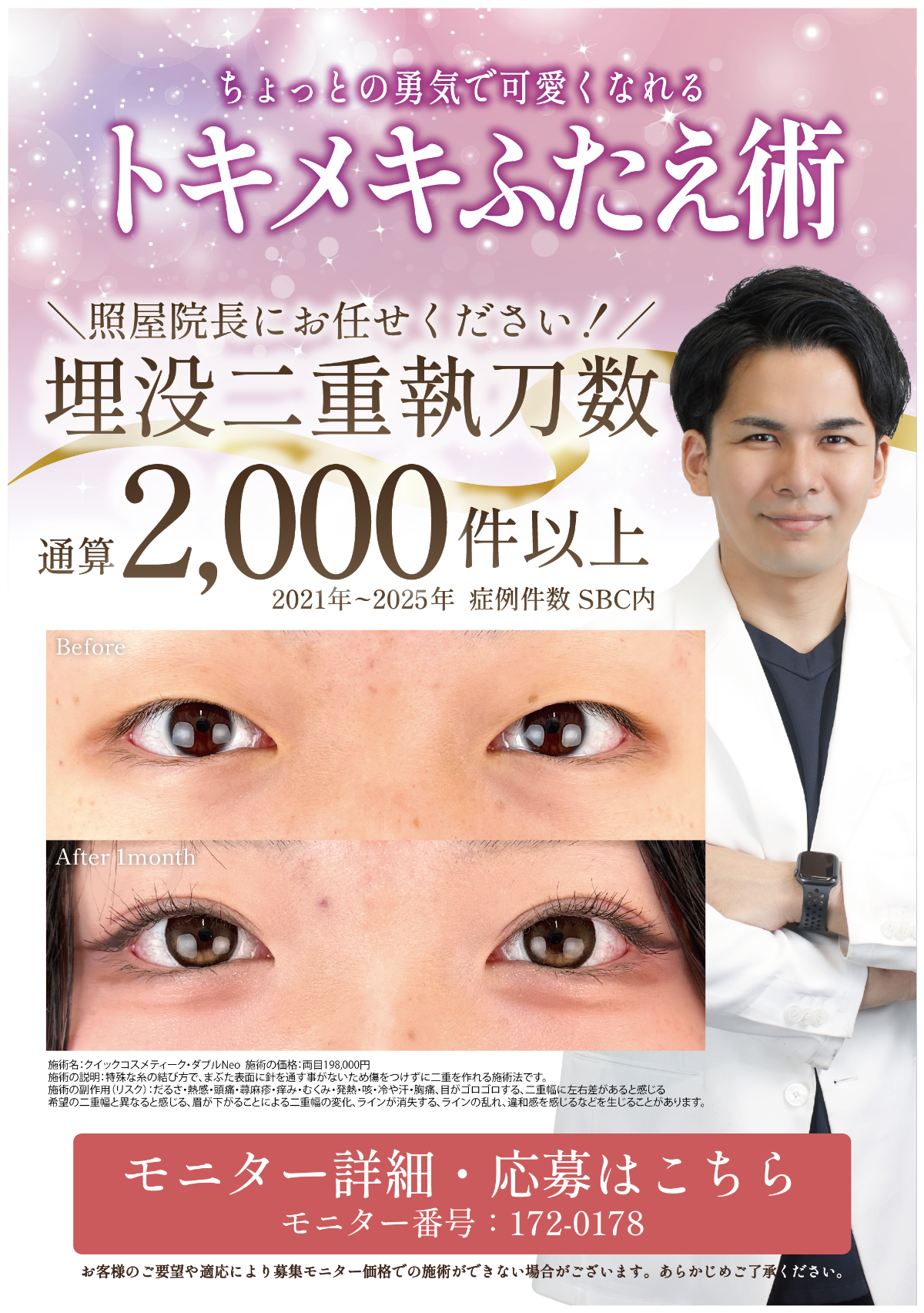 二重