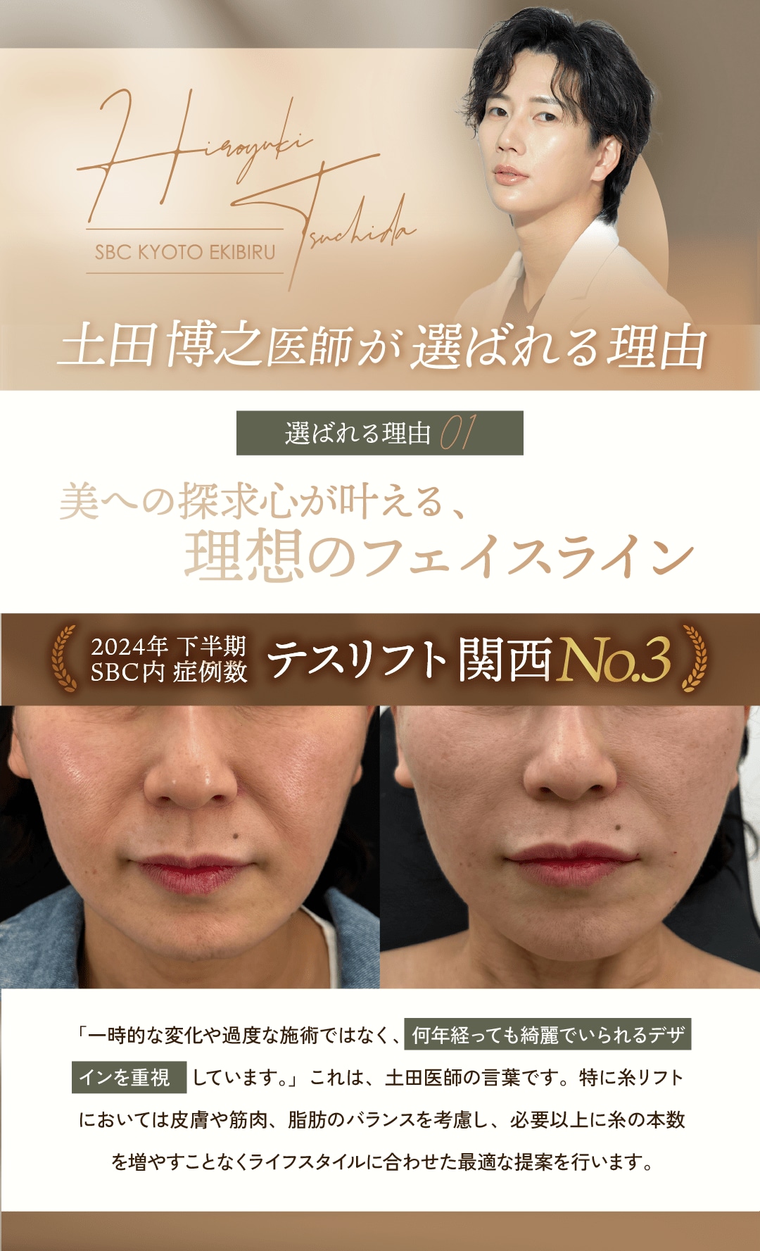 選ばれる理由