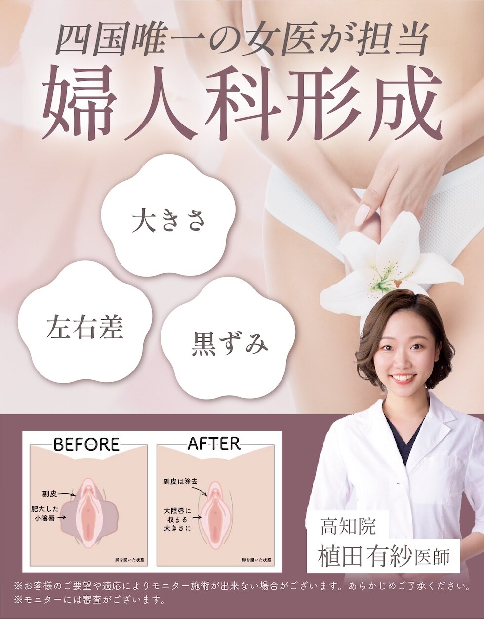 婦人科形成