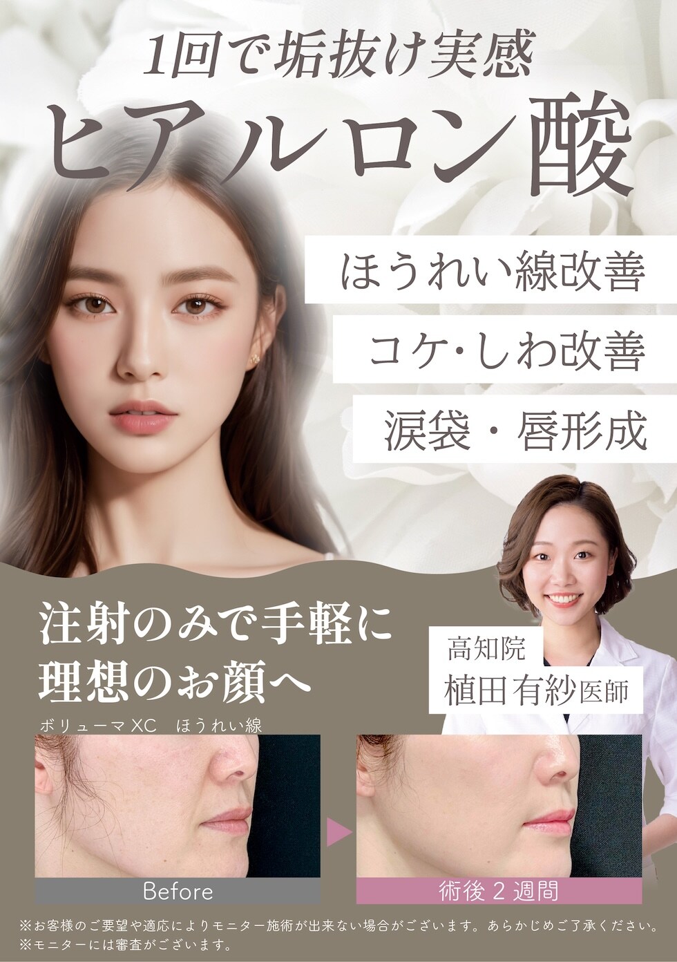 ヒアルロン酸