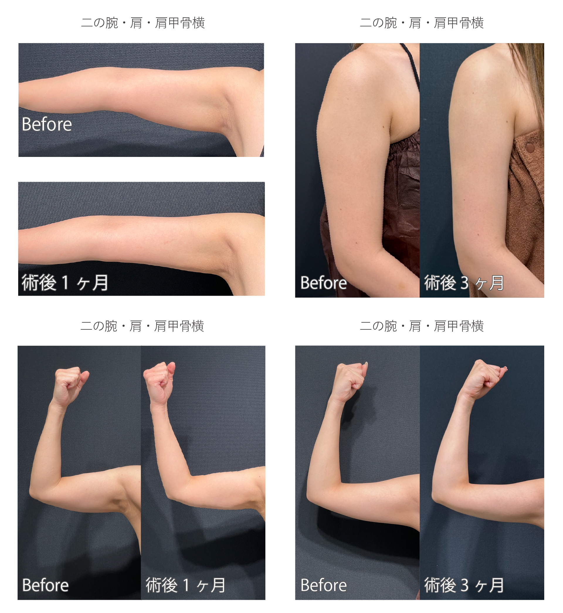 症例写真