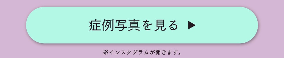 症例写真を見る