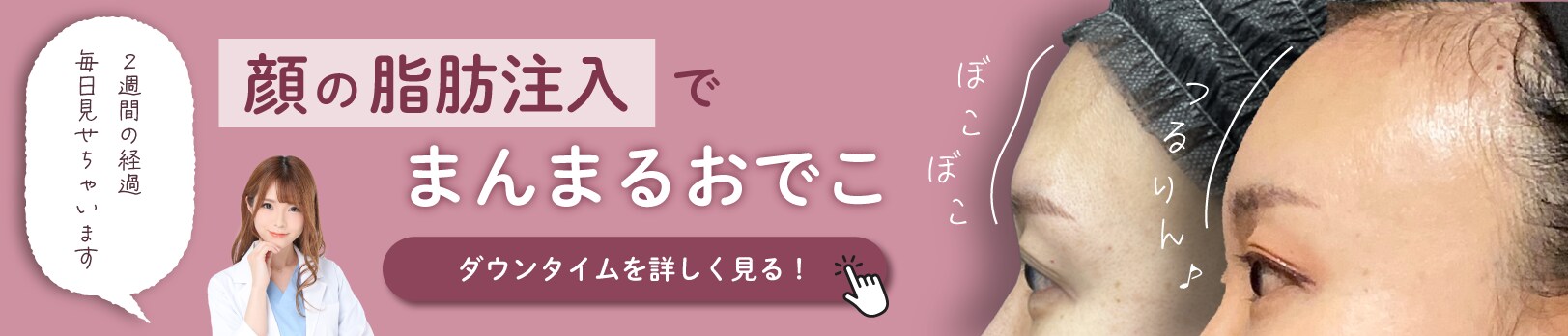 モニター募集