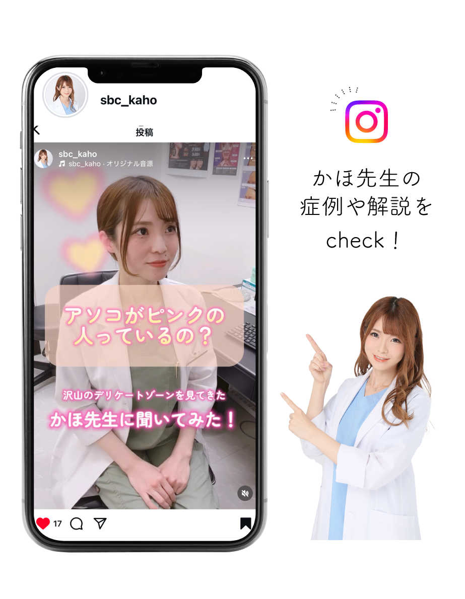 モニター募集