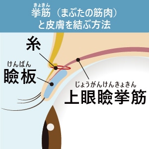 挙筋法
