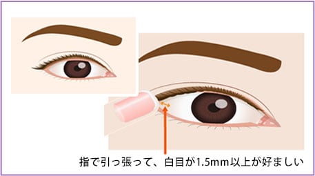 指で引っ張って、白目が1.5mm以上が好ましい