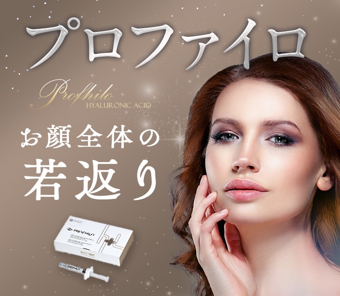 プロファイロ