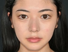 今月のベスト症例写真
