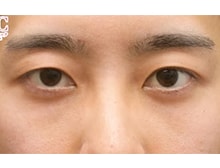 今月のベスト症例写真