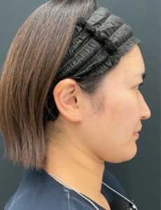 術前