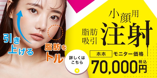 脂肪吸引注射 90,000円