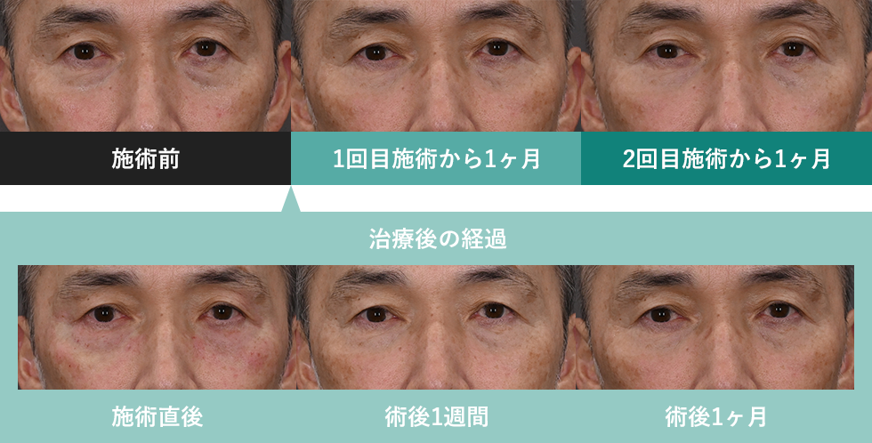 症例写真1