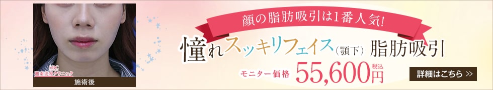 美ボディ脂肪吸引(あご下)