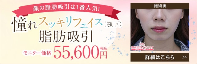 美ボディ脂肪吸引(あご下)