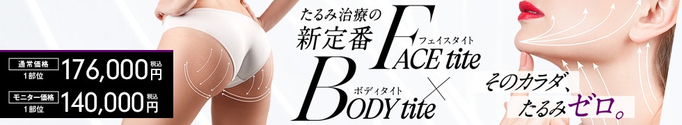 エンブレイスRF