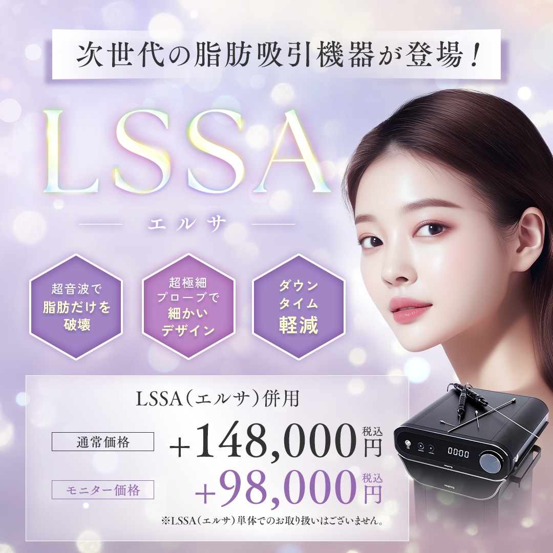 LSSA（エルサ）