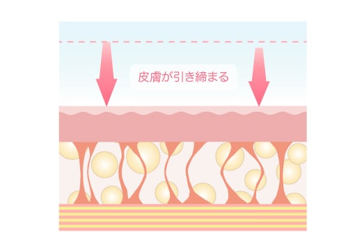 皮膚をタイトニング(引き締め) 画像