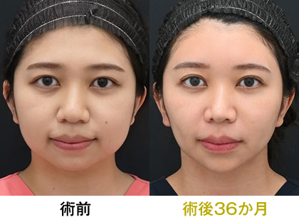 ピックアップ症例写真01