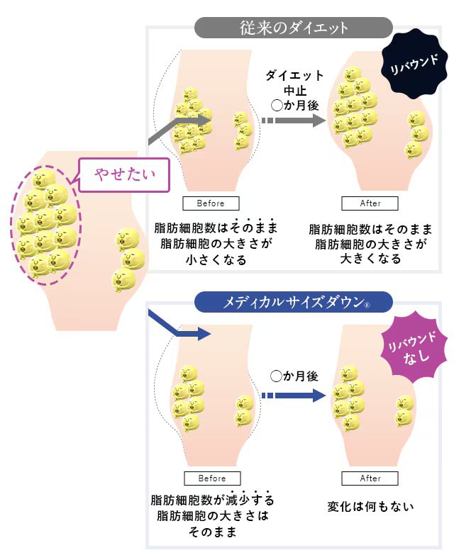 従来のダイエットとメディカルサイズダウン&reg;の違い
