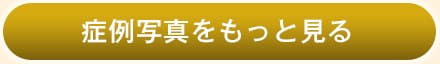 症例写真をもっと見る
